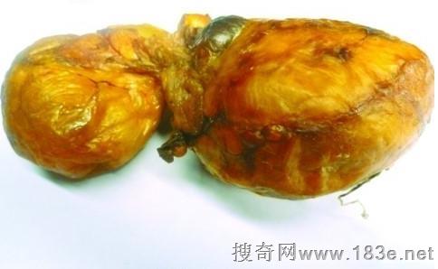 贵州病牛报答喂养之恩！吐出价值4万牛黄