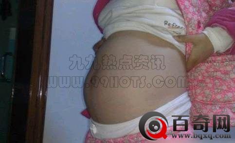 黑龙江女孩怀孕却生下20只老鼠