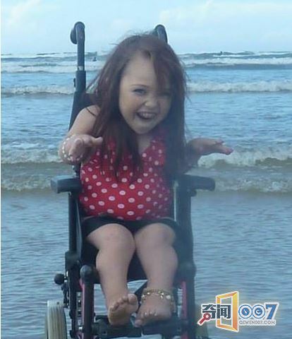 19岁花样少女，身体却像两岁婴儿