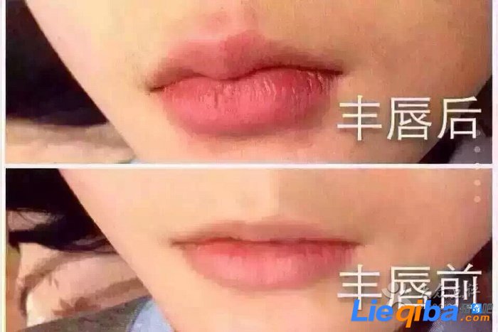 大学寝室四女生整形求嘟嘟嘴 是为了以后方便找工作_1