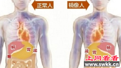 世界上真的有镜像人吗？