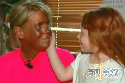 最近流行的“美黑”,一不小心会黑的很惨