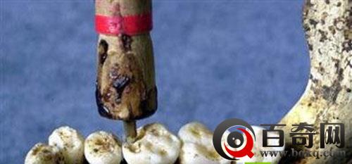 2000年前的整容术 古代神奇的“超前”发明