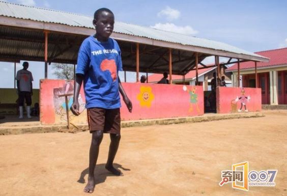 上万儿童患罕见点头病，十几岁就面临死亡