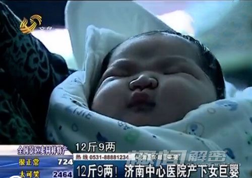 打破记录！济南产妇生下12斤9两女巨婴