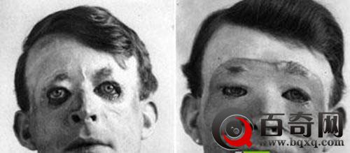 2000年前的整容术 古代神奇的“超前”发明