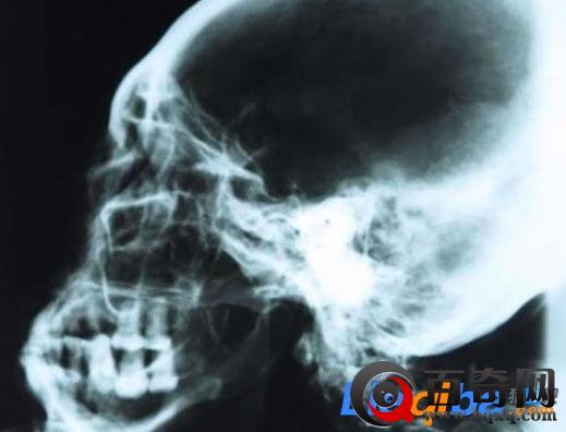 秘鲁发现外星人木乃伊 有3只手指及脚趾