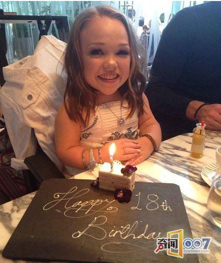 19岁花样少女，身体却像两岁婴儿