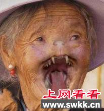 哈尔滨猫脸老太太事件揭秘