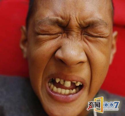 奇葩菲律宾召集300名小男孩现场割礼，志创吉利斯世界记录