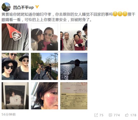 网友曝黄景瑜劈腿家暴 晒女方脸部受伤正面照