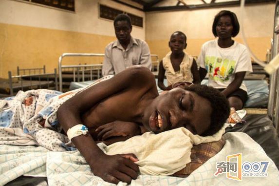 上万儿童患罕见点头病，十几岁就面临死亡