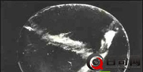 2000年前的整容术 古代神奇的“超前”发明