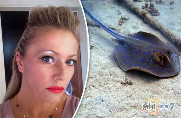 女子泰国度假遭黄貂鱼攻击 险象环生