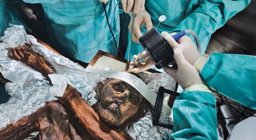 欧洲冰封5300年冰人木乃伊