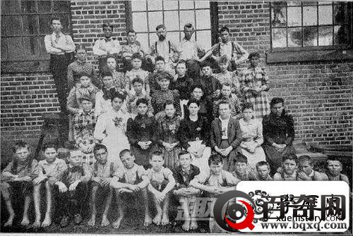 丧尽天良!史上十大灭绝人性的人体试验