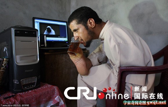 加沙小伙练就一身腿上功夫 但天生无臂