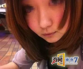 丈夫酒后下体疼痛，问及原因妻子脸红