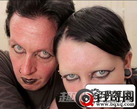 历数全世界最神奇恐怖的十大怪病！