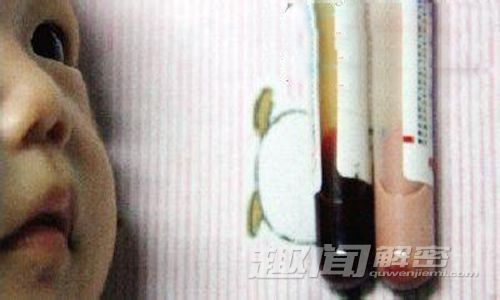 河南某婴儿患怪病 血液竟然是粉红色！
