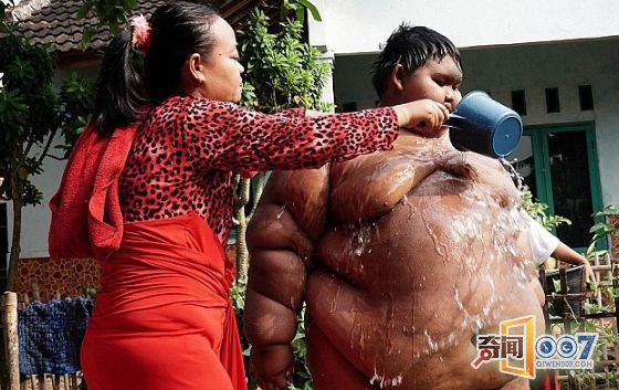 永远饥饿”的男孩