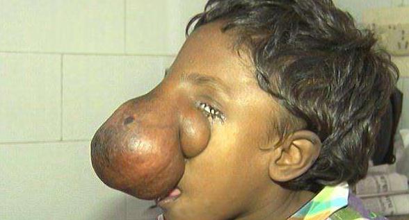 印度男孩长象鼻 被当神的化身_0