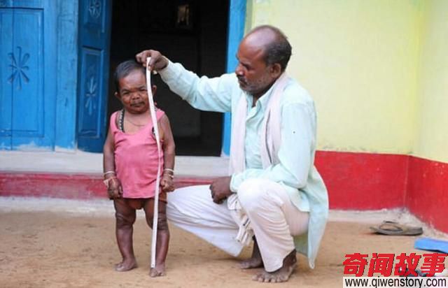 印度男子患侏儒症，身高只有73cm，村里人把他当成英雄来膜拜