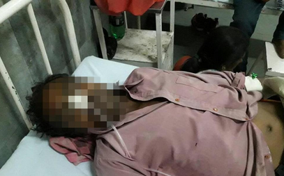 印度男子腹中有个酒瓶 竟是喝酒时吞下去的_0