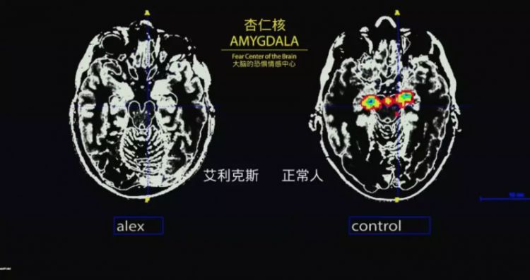 豆瓣9.1，每天都有无数人问他死了吗？