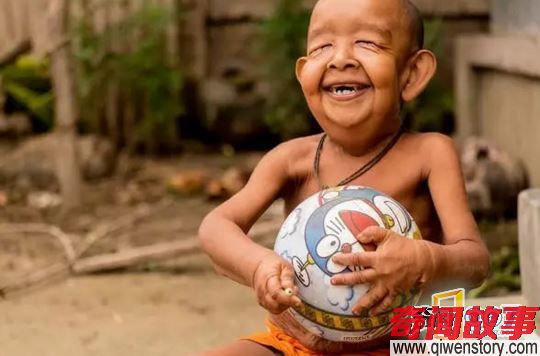 4岁男孩像80岁老翁