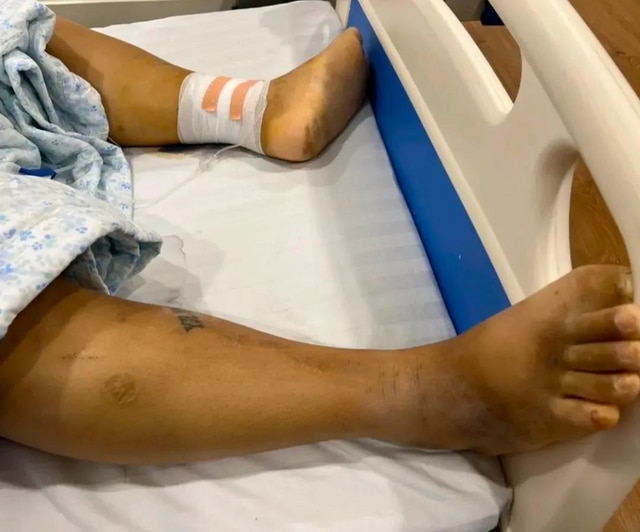 江苏小伙在柬埔寨沦为血奴，每45天抽3袋血，被救时血几乎被抽干