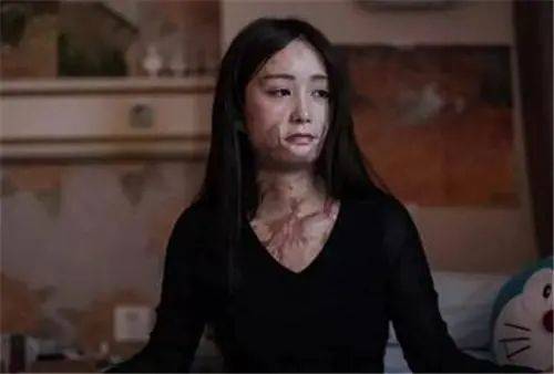 9年前，那位拒绝官二代表白，被汽油烧毁容的16岁女孩，现怎样了