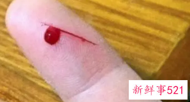 女人做梦见血什么意思