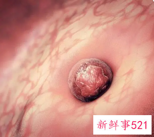 怀孕3周着床了吗