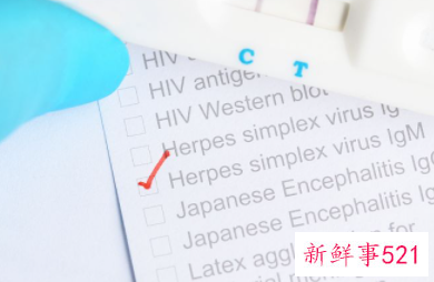 总胆红素高是怎么回事