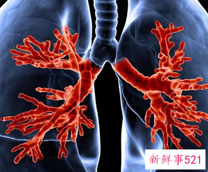 咳嗽会不会造成肺炎