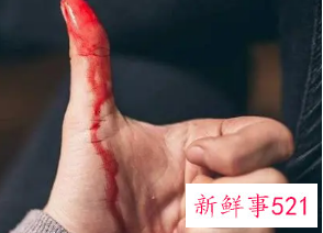 梦见自己手腕流血是什么意思