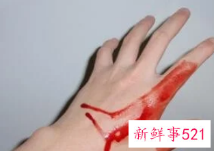 梦见自己手腕流血是什么意思