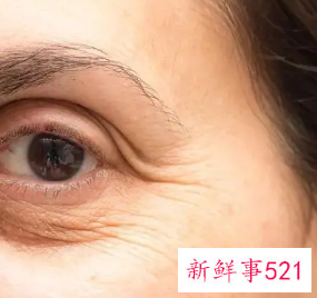 年轻人皮肤松弛的原因是