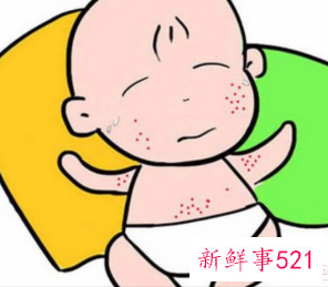 幼儿急疹为什么不能碰水呢