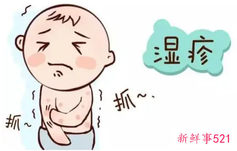 肚脐眼湿疹会是什么原因