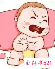 幼儿急疹为什么不能碰水呢