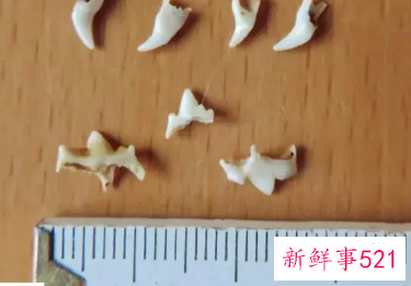 换牙乳牙断了牙根还在里面