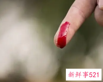 梦见手腕开刀是什么含义