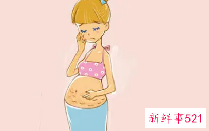 妊娠纹预防护理的方法