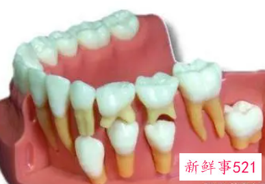 换牙乳牙断了牙根还在里面