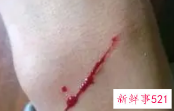 女人做梦见血什么意思