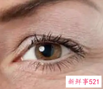 年轻人皮肤松弛的原因是