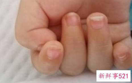 宝宝吃手指的原因有哪些