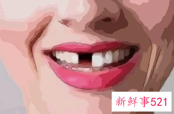 梦见掉门牙是什么意思